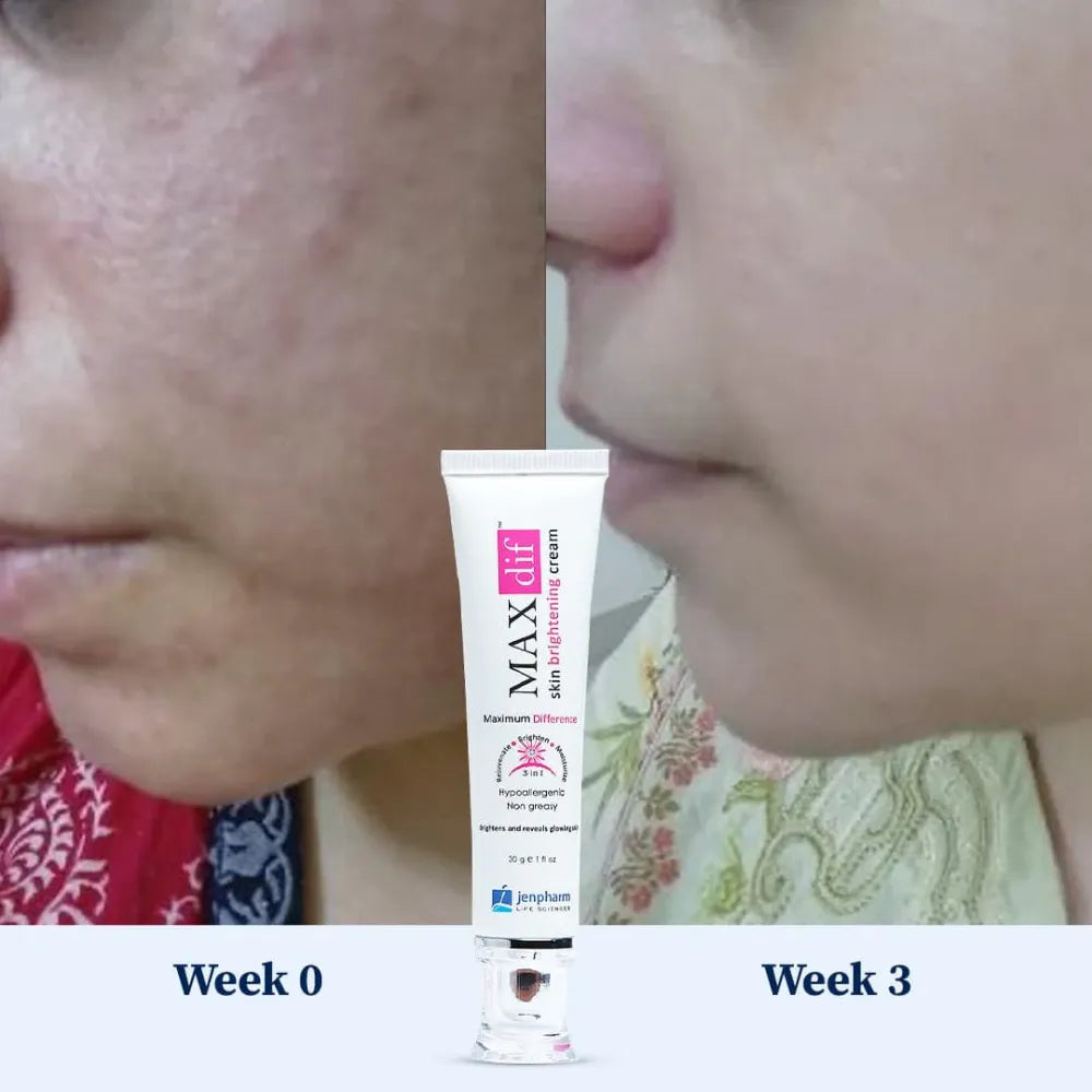 Maxdif Brightening Cream 40g
